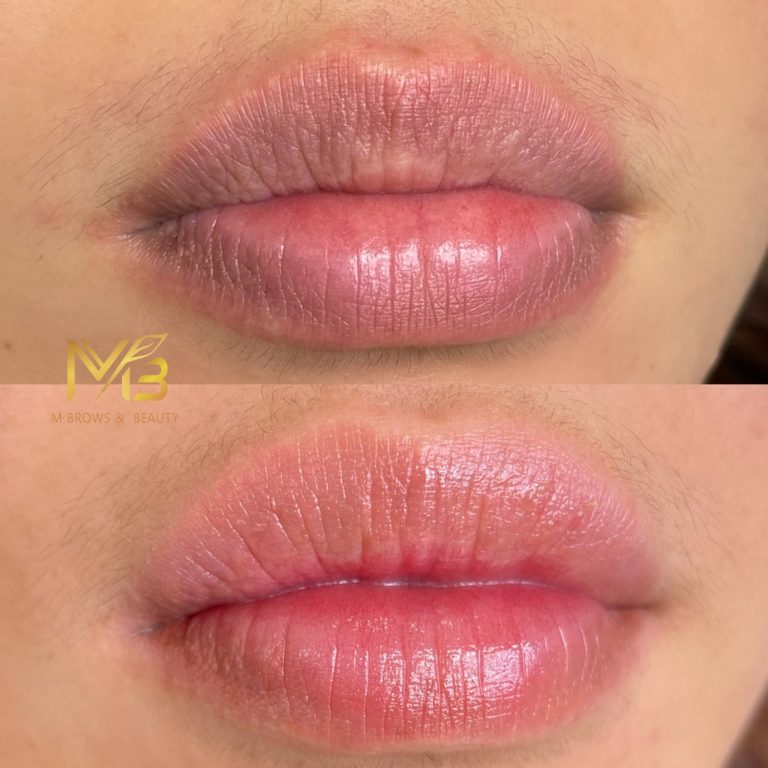 M Brows and Beauty Close-up of lips shown in two images: the top shows natural, dry lips, whilst the bottom displays the same lips after treatment, appearing more hydrated and with a glossier, more even pink tone. The logo "MBrows & Beauty" is in the corner.